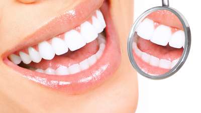 6-teeth-whitening-tips.jpg